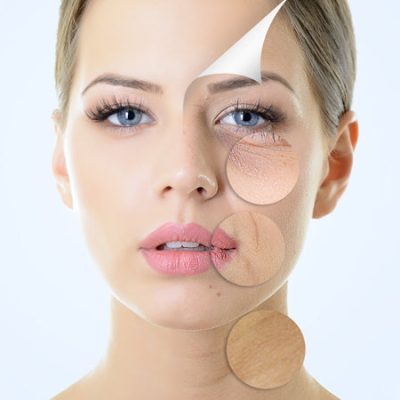 portrait_of_beautiful_woman_with_problem_and_clean_skin